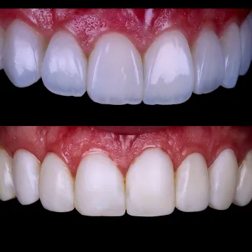 نمونه کار لمینت