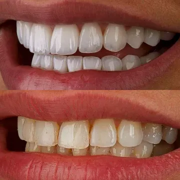 نمونه کار لمینت